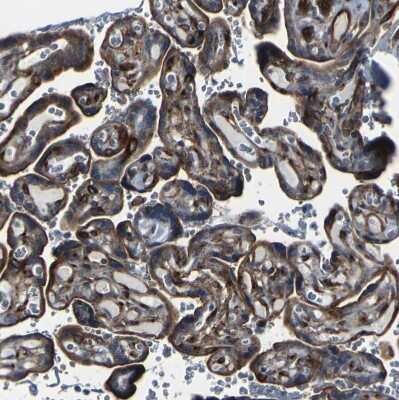 Immunohistochemistry-Paraffin: Myoferlin Antibody [NBP1-84694]