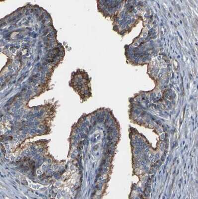 Immunohistochemistry-Paraffin: Myoferlin Antibody [NBP1-84694]