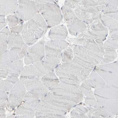Immunohistochemistry-Paraffin: Myoferlin Antibody [NBP1-84694]
