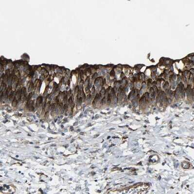 Immunohistochemistry-Paraffin: Myoferlin Antibody [NBP1-84694]