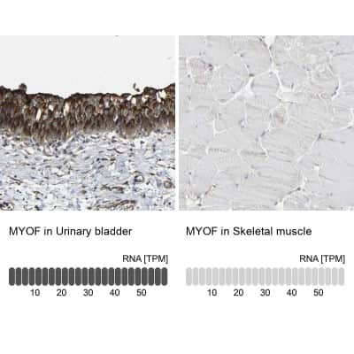 Immunohistochemistry-Paraffin: Myoferlin Antibody [NBP1-84694]