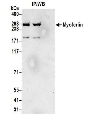 Immunoprecipitation: Myoferlin Antibody [NBP2-32264]