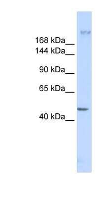 Western Blot: Myoferlin Antibody [NBP1-59396]