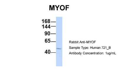 Western Blot: Myoferlin Antibody [NBP1-59396]
