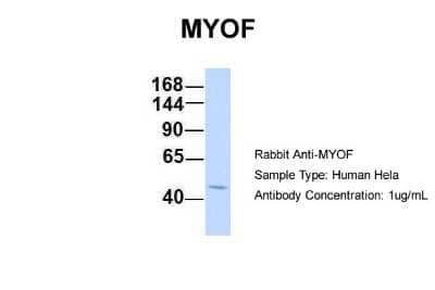 Western Blot: Myoferlin Antibody [NBP1-59396]