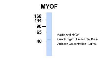 Western Blot: Myoferlin Antibody [NBP1-59396]