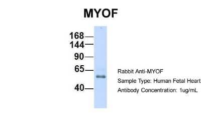 Western Blot: Myoferlin Antibody [NBP1-59396]