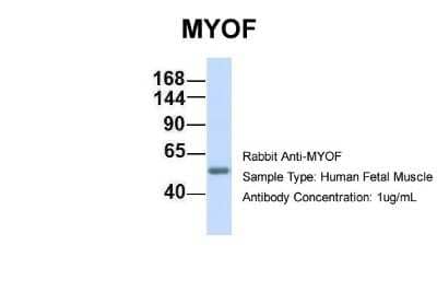 Western Blot: Myoferlin Antibody [NBP1-59396]