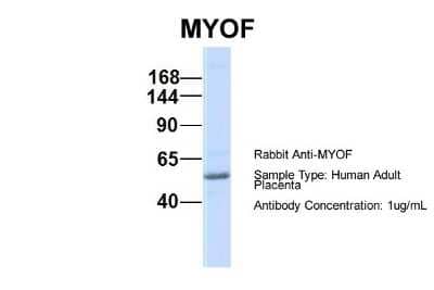 Western Blot: Myoferlin Antibody [NBP1-59396]