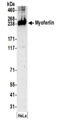 Western Blot: Myoferlin Antibody [NBP2-32264]