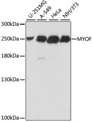 Western Blot: Myoferlin AntibodyAzide and BSA Free [NBP2-94759]