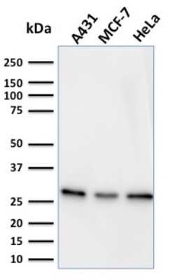Western Blot: Myofibroblast Marker Antibody (PR 2D3)Azide and BSA Free [NBP3-08768]