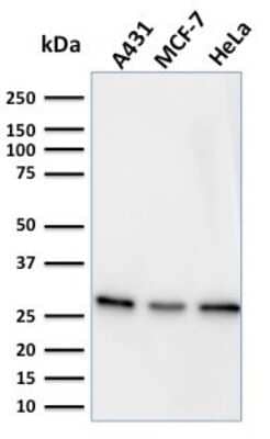 Western Blot: Myofibroblast Marker Antibody (PR 2D3) [NBP3-07745]