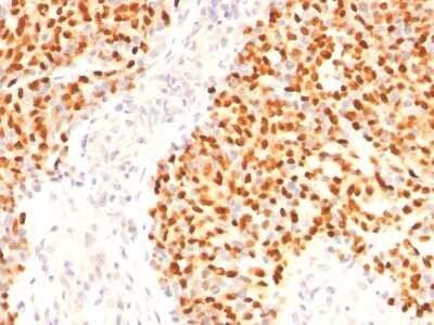 Immunohistochemistry-Paraffin: Myogenin Antibody (F5D) - Azide and BSA Free [NBP2-34616]