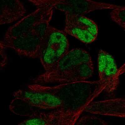 Immunocytochemistry/ Immunofluorescence: Myogenin Antibody [NBP2-54972]