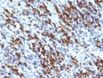 Immunohistochemistry-Paraffin: Myogenin Antibody (MGN185 + F5D) - Azide and BSA Free [NBP2-34684]