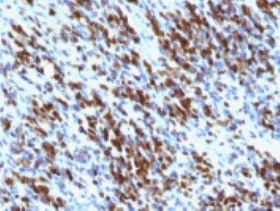 Immunohistochemistry-Paraffin: Myogenin Antibody (MGN185 + F5D) [NBP2-34278]