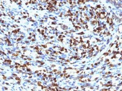 Immunohistochemistry-Paraffin: Myogenin Antibody (MGN185) - Azide and BSA Free [NBP2-33056]