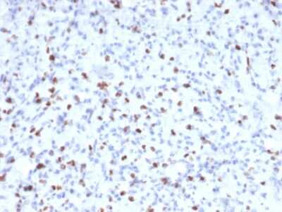 Immunohistochemistry-Paraffin: Myogenin Antibody (MYOG/2660) [NBP3-07405]