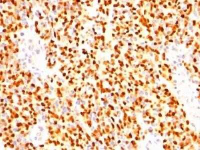 Immunohistochemistry-Paraffin: Myogenin Antibody (SPM144) - Azide and BSA Free [NBP2-34740]