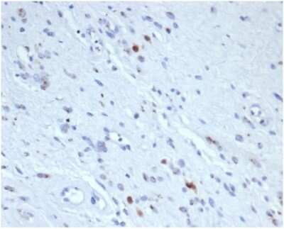 Immunohistochemistry-Paraffin: Myogenin Antibody (rMYOG/6297) [NBP3-13978]