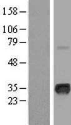 Western Blot: Myogenin Overexpression Lysate [NBL1-13444]