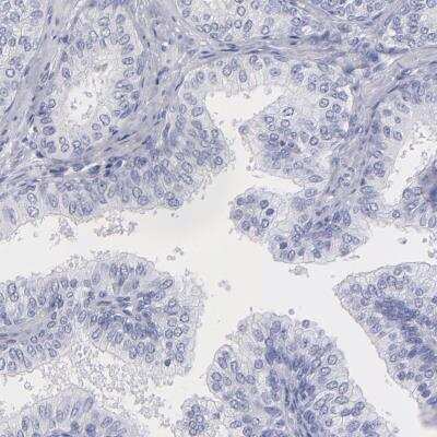 Immunohistochemistry-Paraffin: Myoglobin Antibody [NBP2-54897]