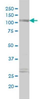 Western Blot: Myomegalin Antibody (2B5) [H00009659-M01]