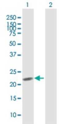 Western Blot: Myomegalin Antibody [H00009659-B01P]