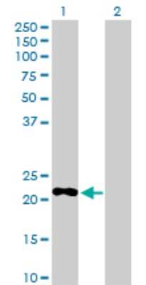 Western Blot: Myomegalin Antibody [H00009659-D01P]