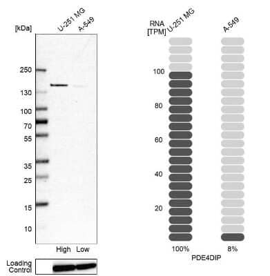 Western Blot: Myomegalin Antibody [NBP1-84428]