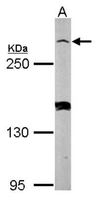 Western Blot: Myomegalin Antibody [NBP2-15031]