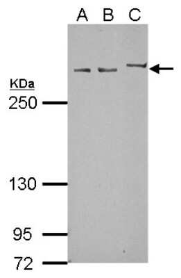 Western Blot: Myomegalin Antibody [NBP2-15031]