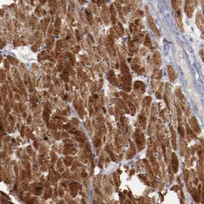 Immunohistochemistry-Paraffin: Myomesin 2 Antibody [NBP1-87496]