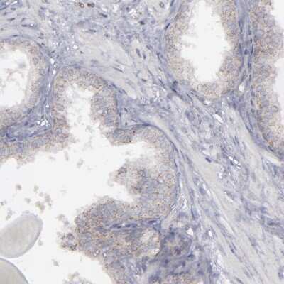 Immunohistochemistry-Paraffin: Myomesin 2 Antibody [NBP1-87496]