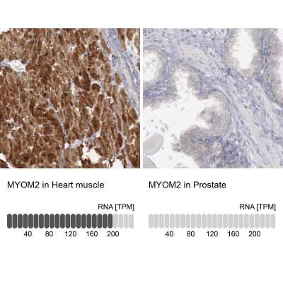 Immunohistochemistry-Paraffin: Myomesin 2 Antibody [NBP1-87496]