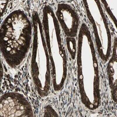 Immunohistochemistry-Paraffin: Myomesin 2 Antibody [NBP1-87591]