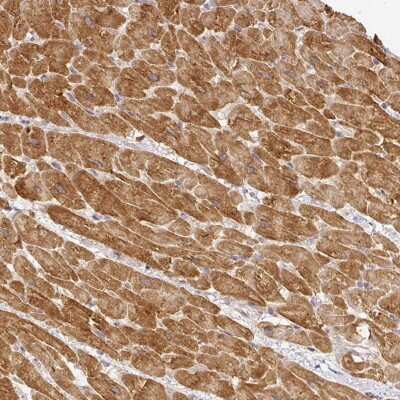 Immunohistochemistry-Paraffin: Myomesin 2 Antibody [NBP1-87591]