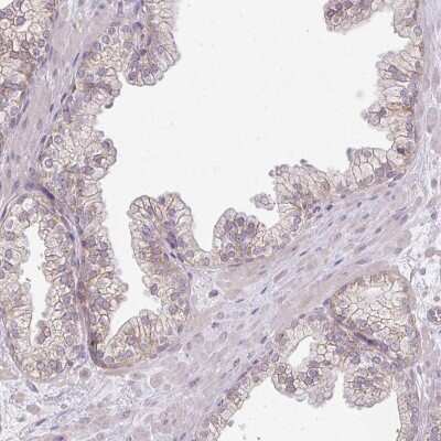 Immunohistochemistry-Paraffin: Myomesin 2 Antibody [NBP1-87591]