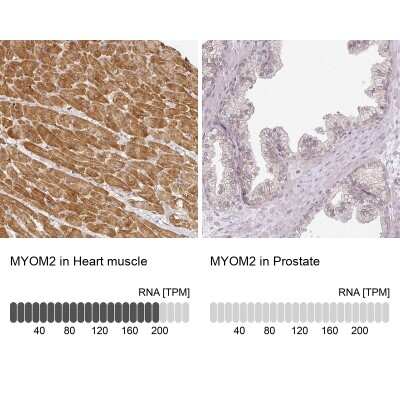 Immunohistochemistry-Paraffin: Myomesin 2 Antibody [NBP1-87591]