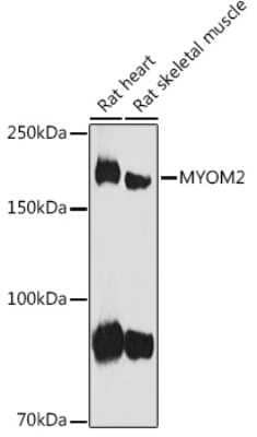 Western Blot: Myomesin 2 AntibodyAzide and BSA Free [NBP3-16037]