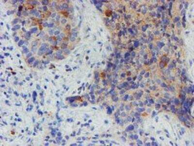 Immunohistochemistry-Paraffin: Myoneurin Antibody (OTI1F10) [NBP2-03899]