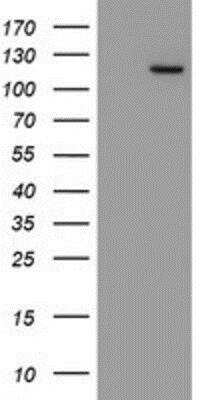 Western Blot: Myoneurin Antibody (OTI1F10) [NBP2-03899]