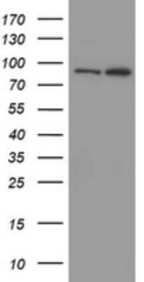 Western Blot: Myoneurin Antibody (OTI3B9) [NBP2-46070]