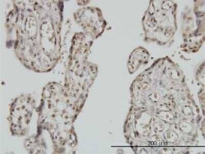 Immunohistochemistry-Paraffin: Myoneurin Antibody (3E8) [H00055892-M01]