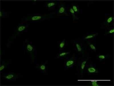 Immunocytochemistry/ Immunofluorescence: Myoneurin Antibody (4B4) [H00055892-M02]