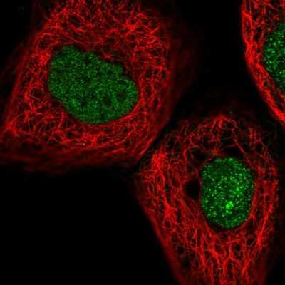 Immunocytochemistry/ Immunofluorescence: Myoneurin Antibody [NBP1-92157]