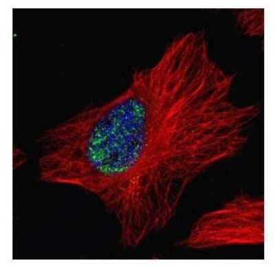 Immunocytochemistry/ Immunofluorescence: Myoneurin Antibody [NBP2-19451]