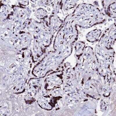 Immunohistochemistry-Paraffin: Myoneurin Antibody [NBP1-92157]