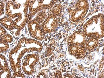 Immunohistochemistry-Paraffin: Myosin 1A Antibody [NBP2-19452]